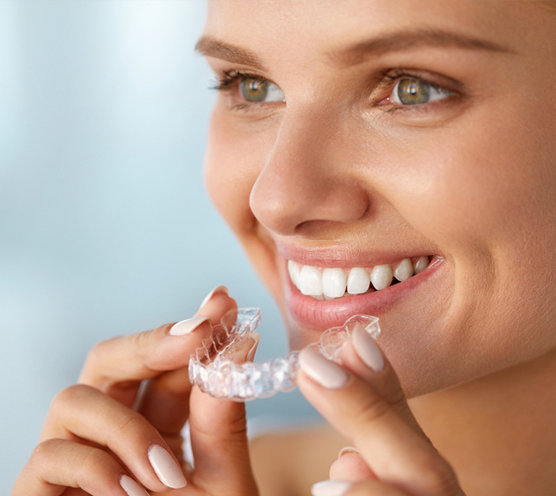 Invisalign-1 Dr. Peter Servinis